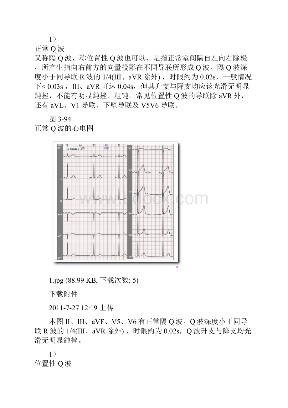 第九讲有关Q波知识.docx_第2页