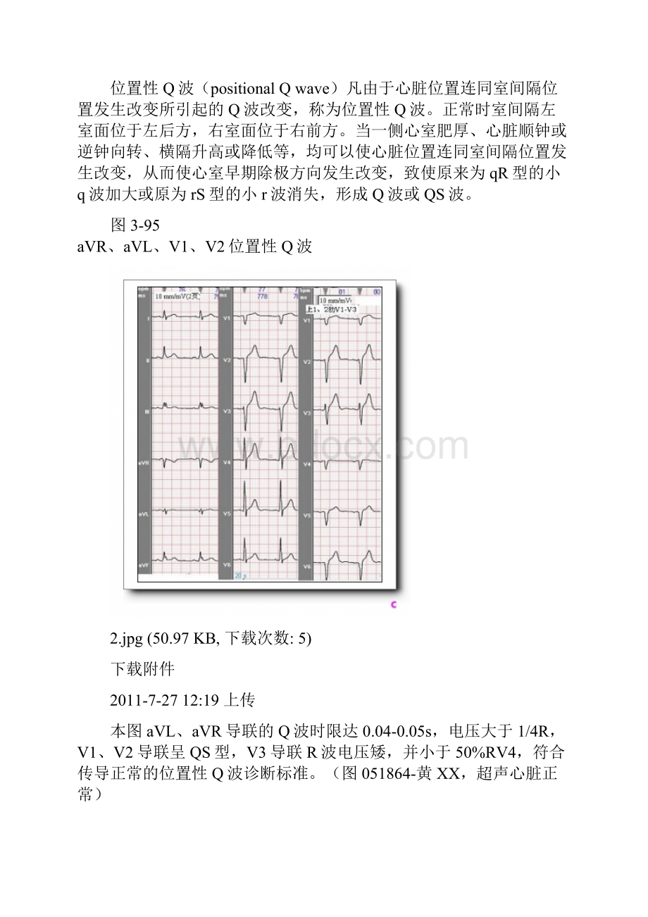 第九讲有关Q波知识.docx_第3页