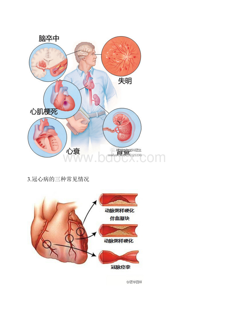 给医学插上翅膀心血管篇.docx_第2页