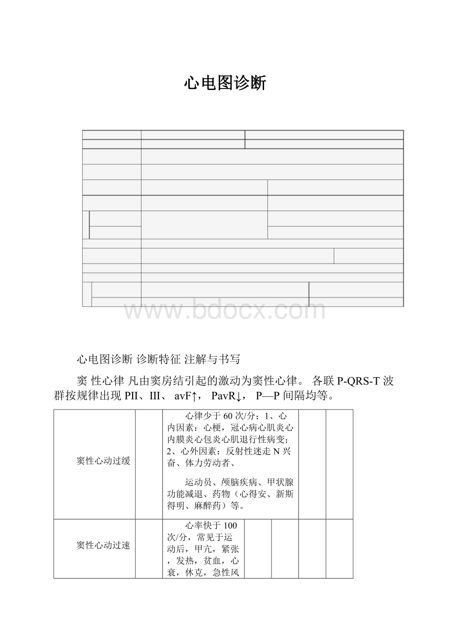 心电图诊断.docx