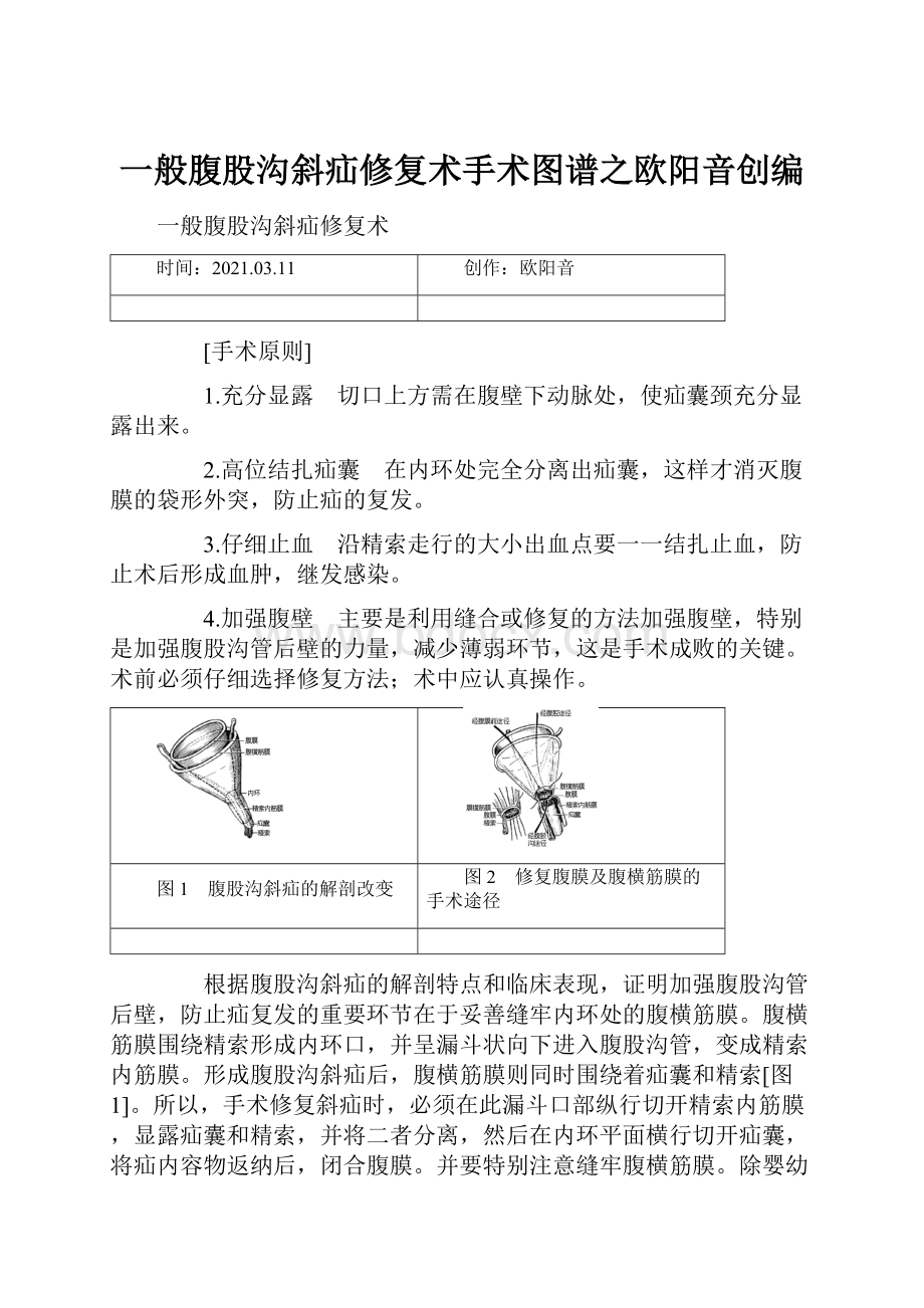 一般腹股沟斜疝修复术手术图谱之欧阳音创编.docx