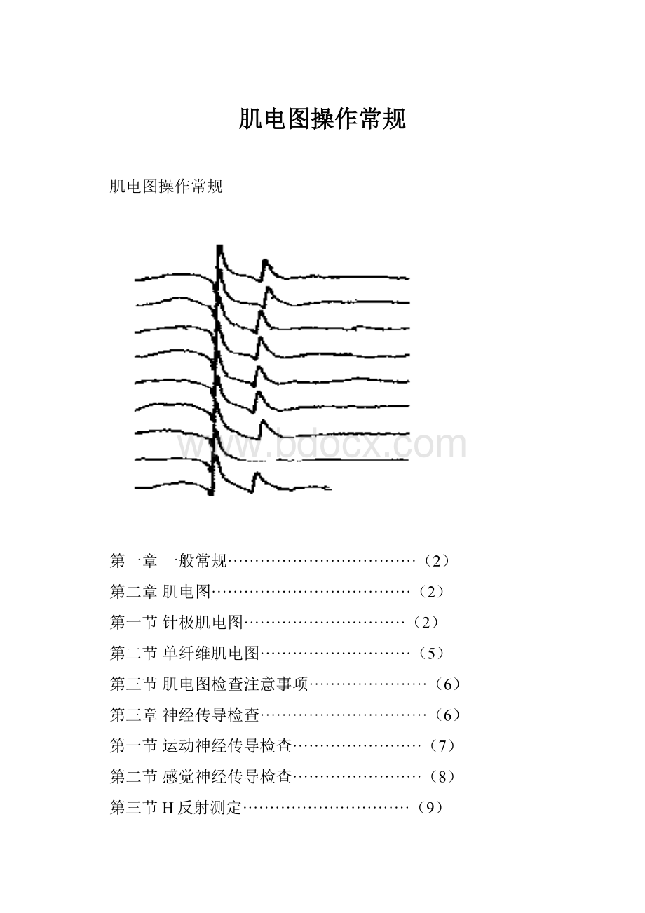 肌电图操作常规.docx