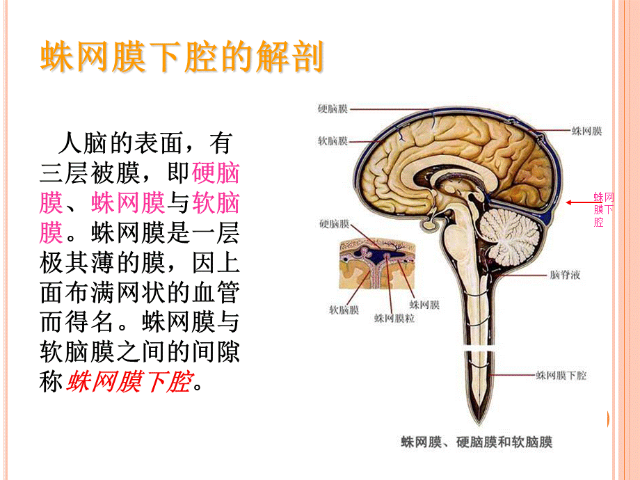 创伤性蛛网膜下腔出血教学查房PPT课件.ppt_第3页