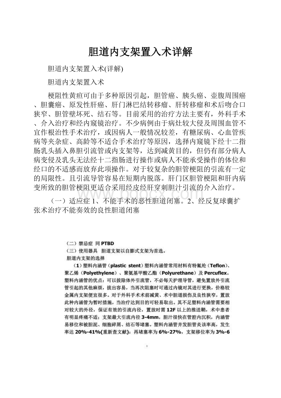 胆道内支架置入术详解.docx_第1页