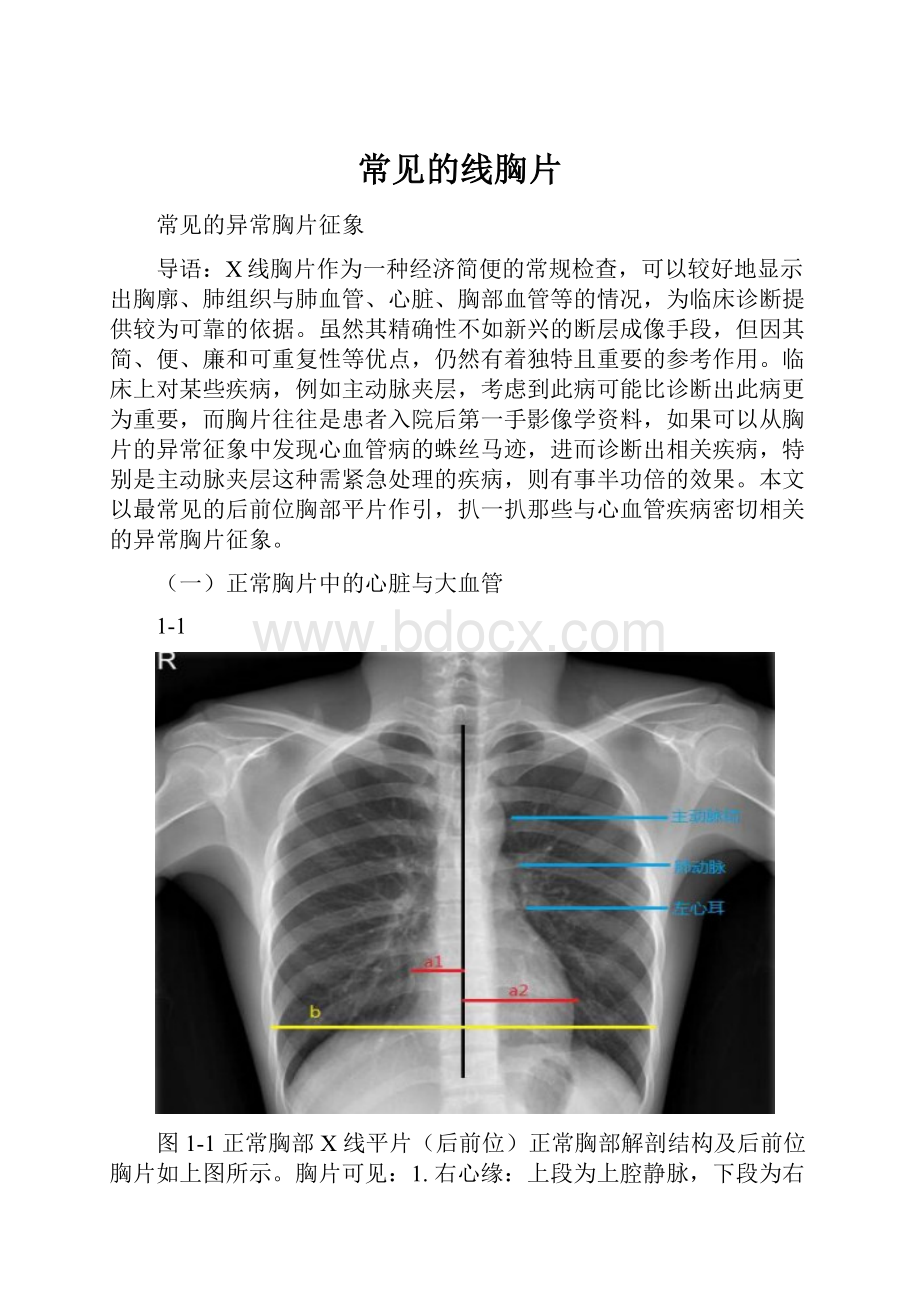 常见的线胸片.docx