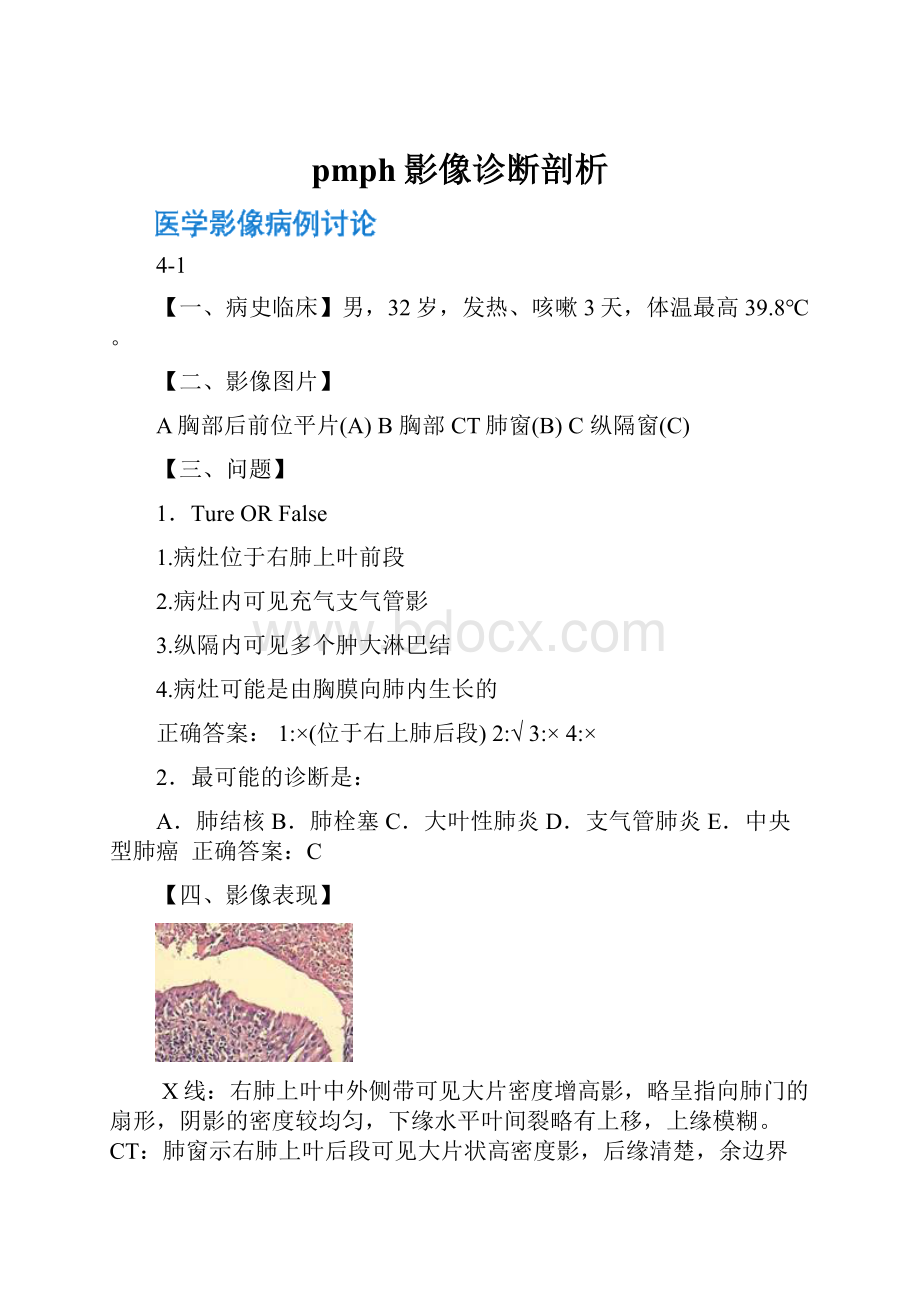 pmph影像诊断剖析.docx_第1页