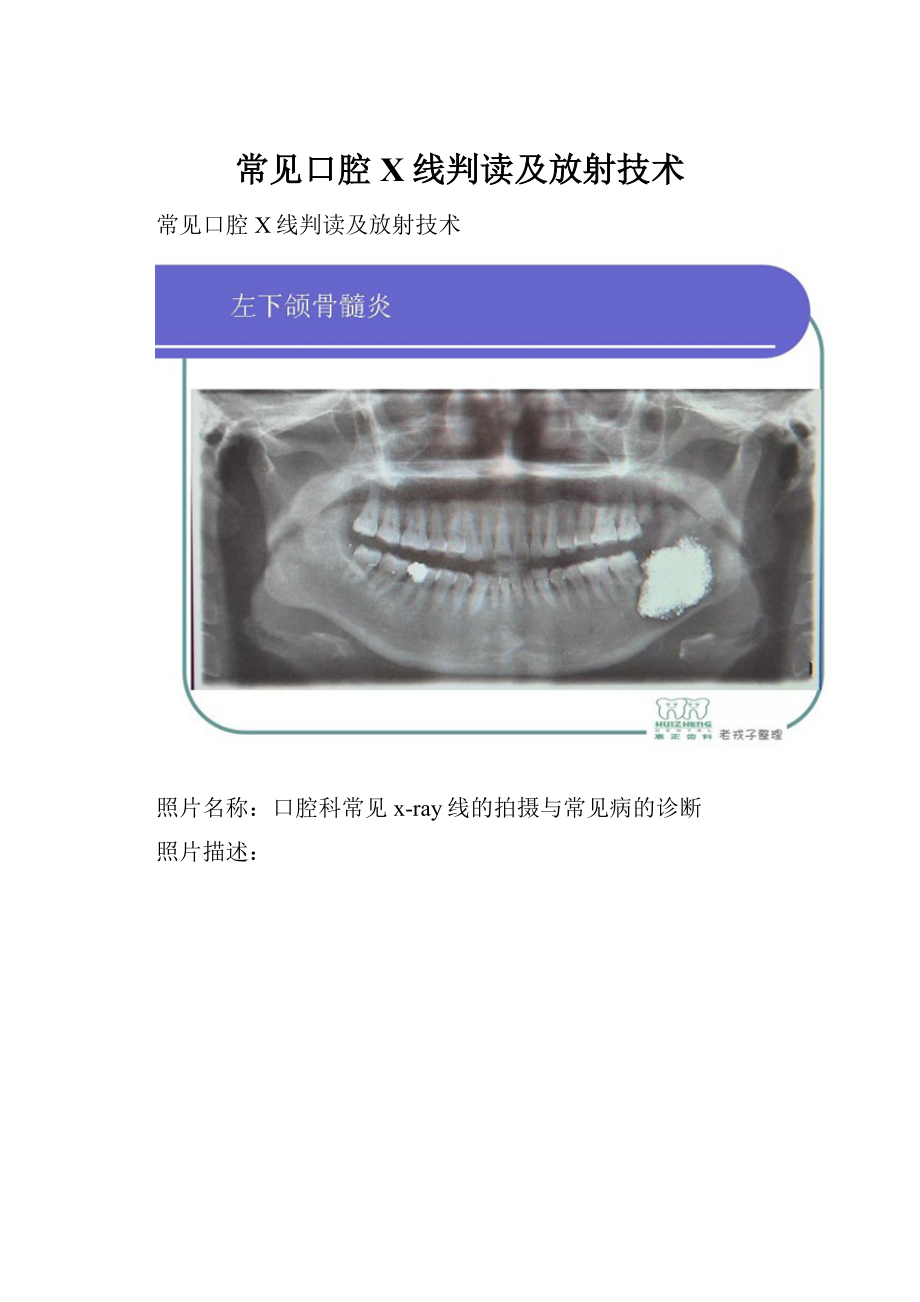 常见口腔X线判读及放射技术.docx