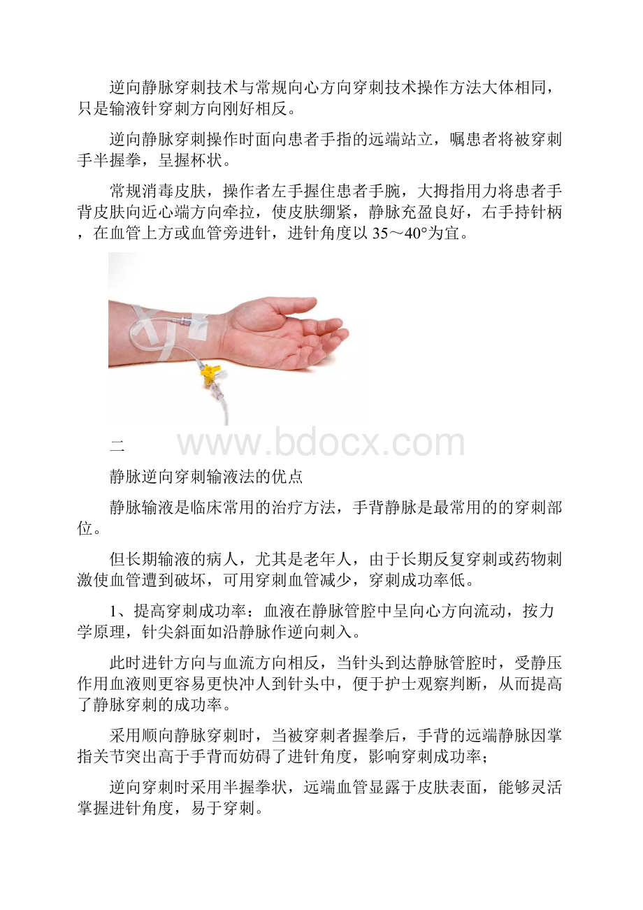 静脉输液护士竟然倒着扎逆行穿刺真可行.docx_第2页