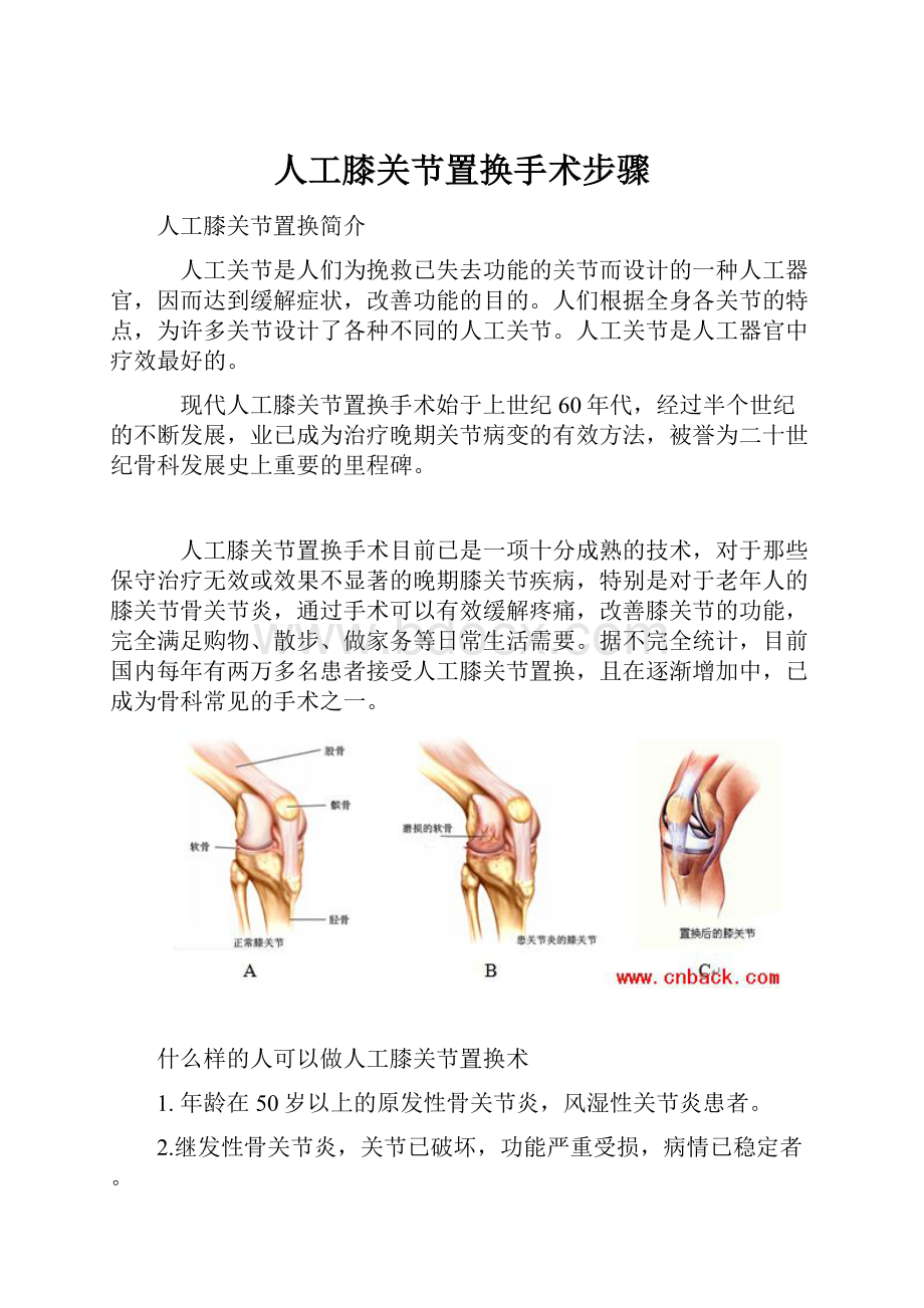 人工膝关节置换手术步骤.docx