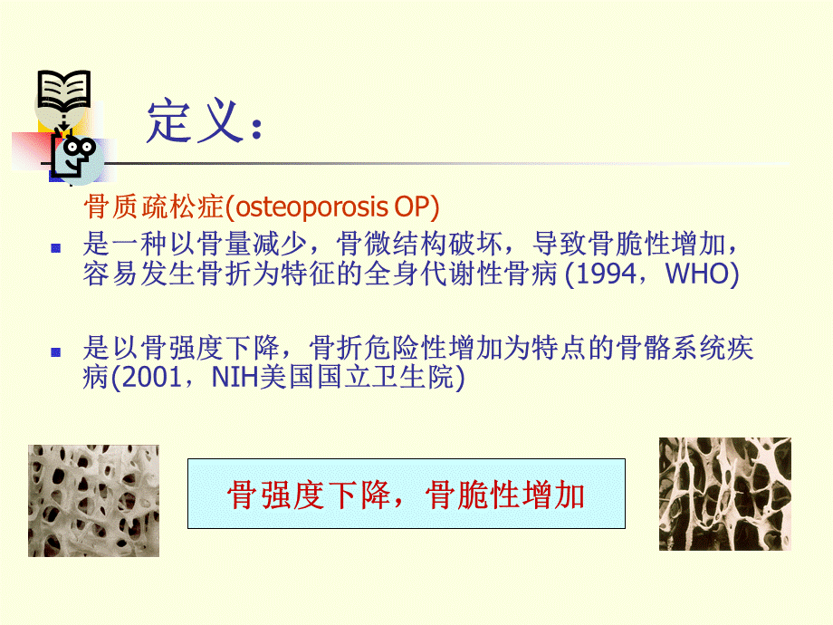 骨质疏松症诊疗指南.ppt_第3页