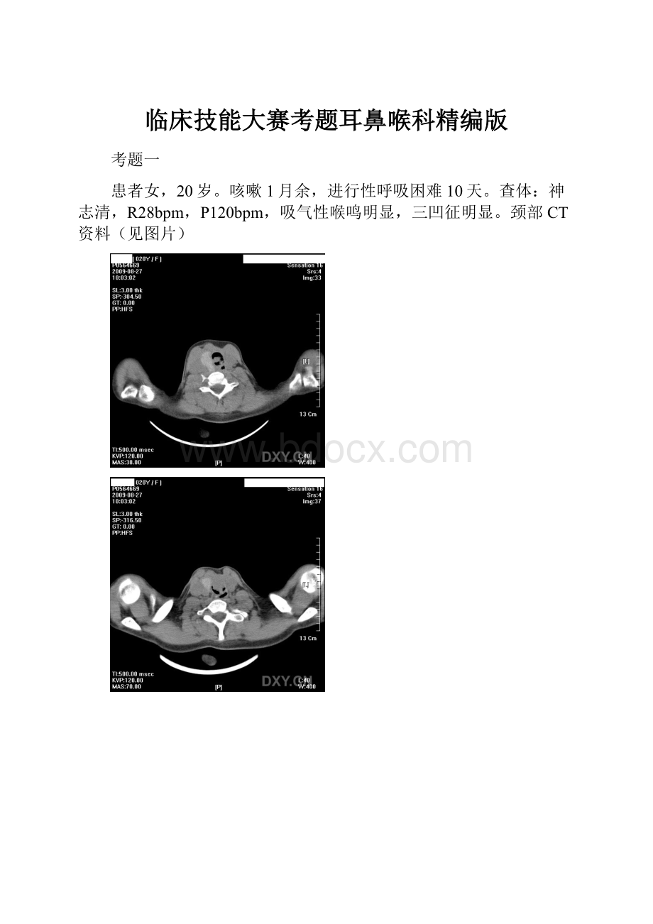 临床技能大赛考题耳鼻喉科精编版.docx