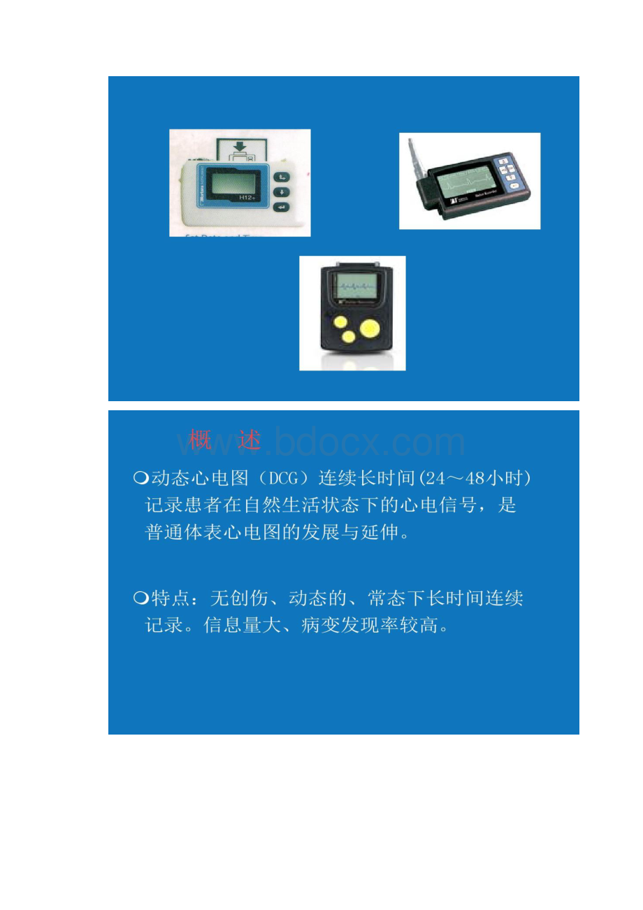 图文动态心电图临床应用汇总.docx_第3页