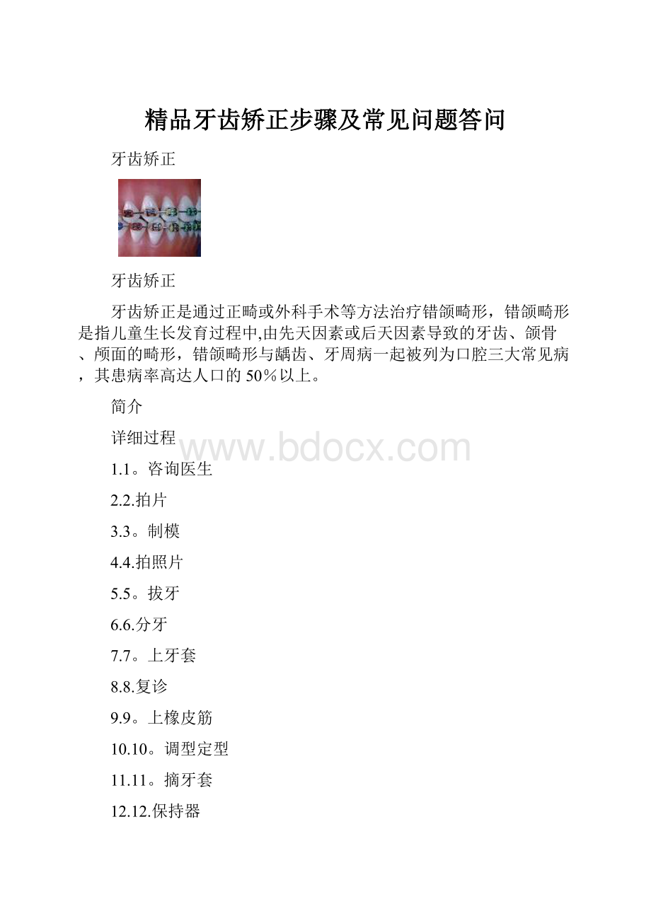 精品牙齿矫正步骤及常见问题答问.docx_第1页