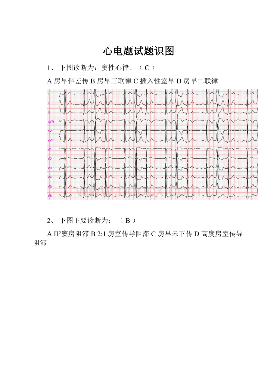 心电题试题识图.docx