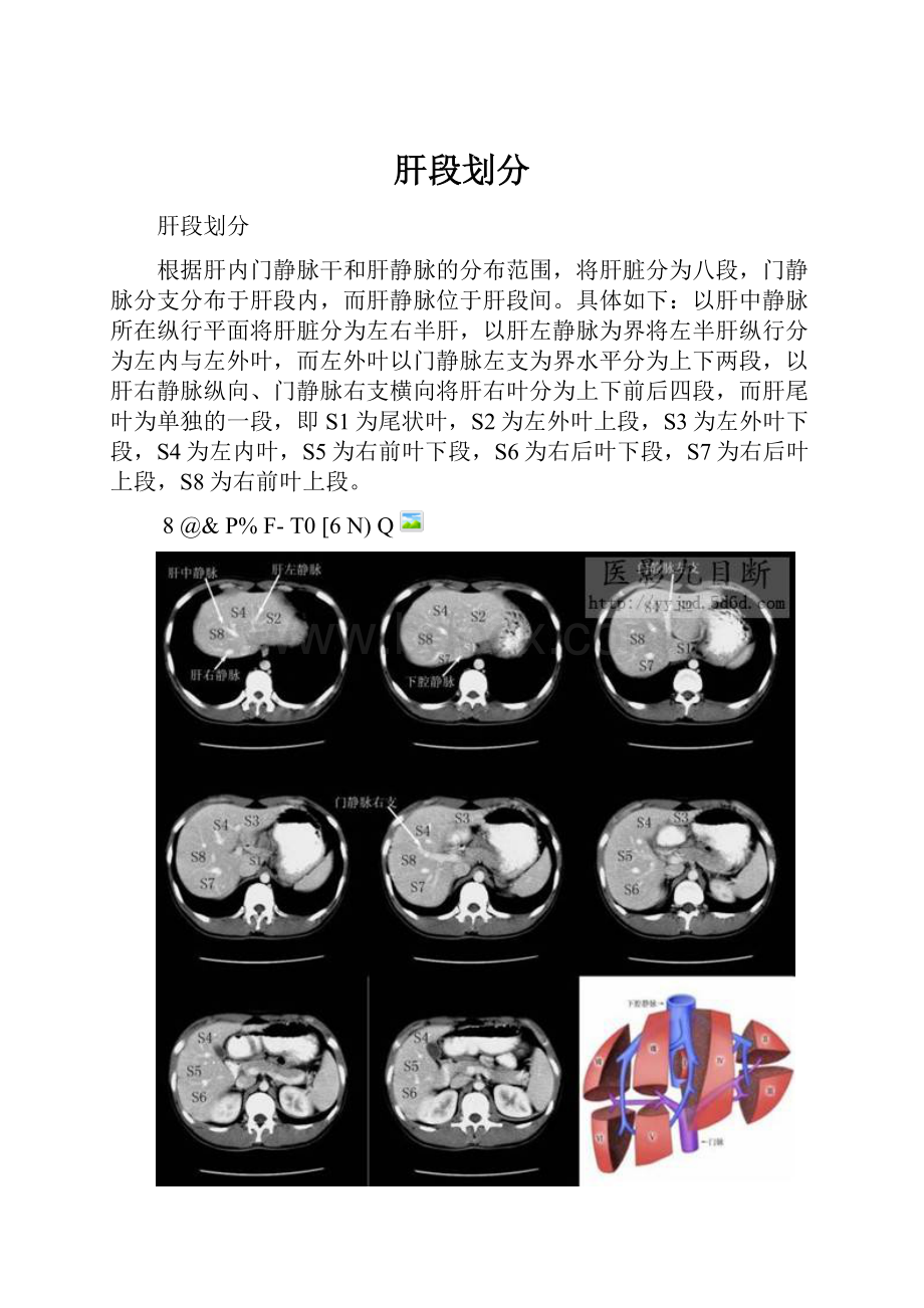 肝段划分.docx_第1页