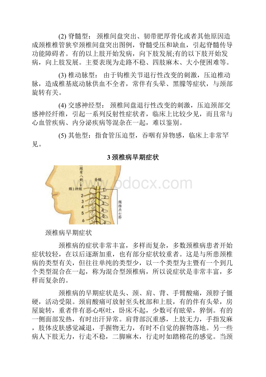 颈椎病 Cervical spondylosis阐述.docx_第3页