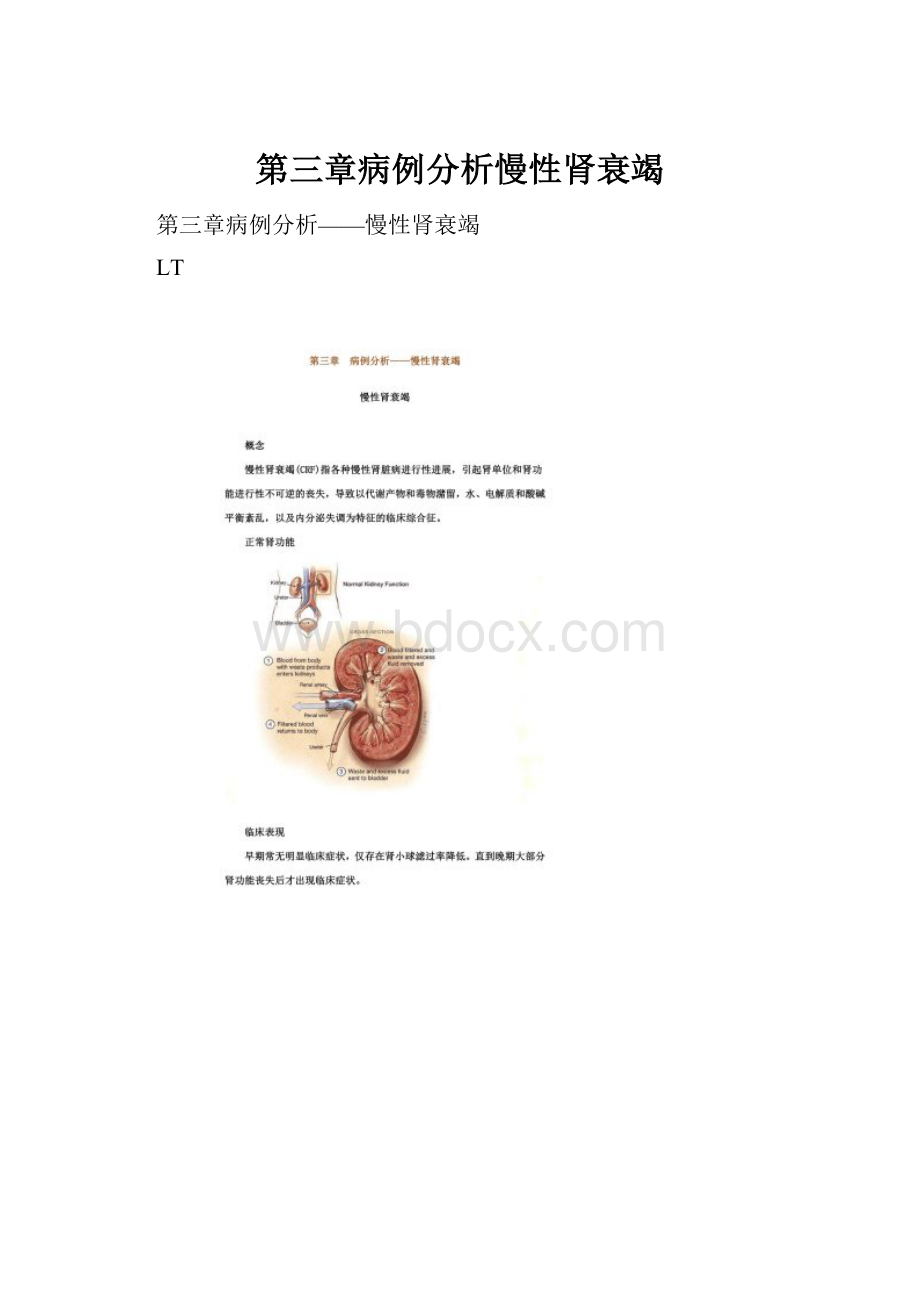 第三章病例分析慢性肾衰竭.docx_第1页