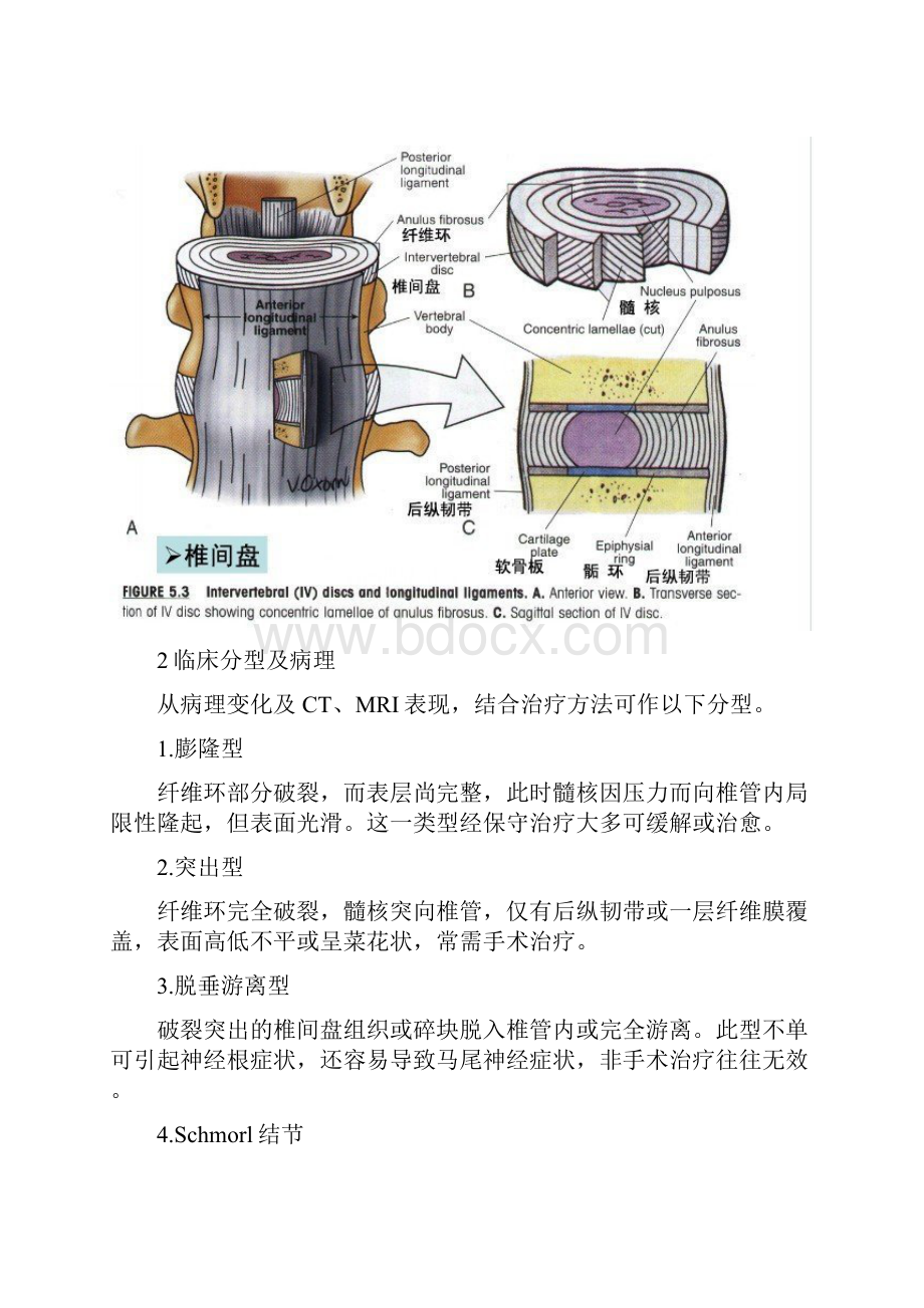 腰椎间盘突出的原因和治疗方法.docx_第3页