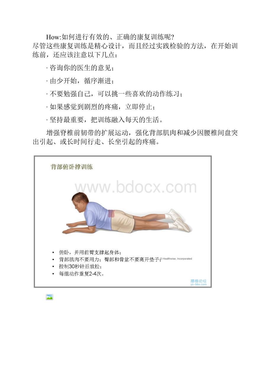 针对腰突引起腰疼的康复训练方法.docx_第2页