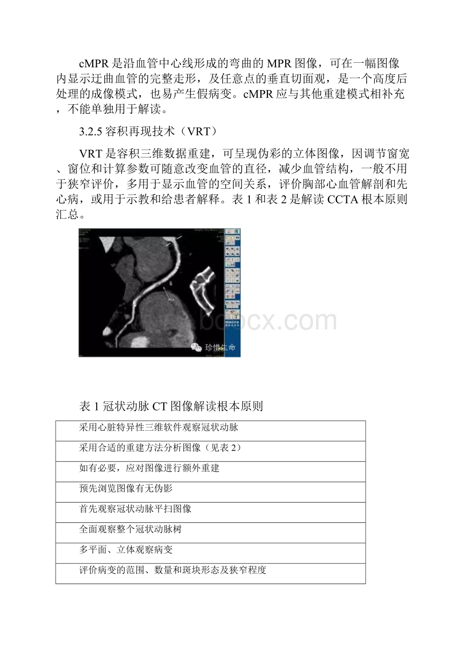 冠状动脉CT图像解读和报告指南SCCT指南.docx_第3页