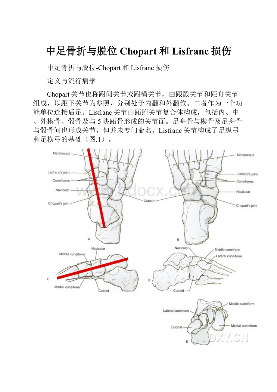 中足骨折与脱位Chopart和Lisfranc损伤.docx