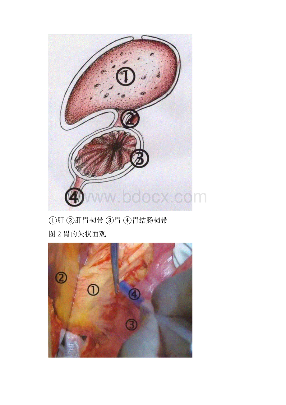 最新手术图解胃癌根治术一胃的毗邻和腹膜汇总资料.docx_第3页