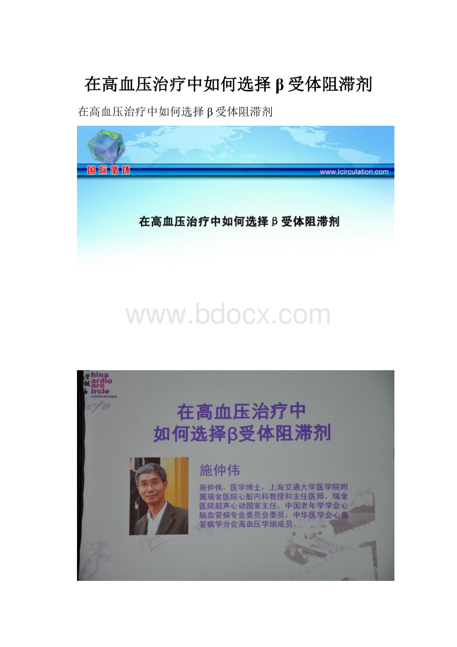 在高血压治疗中如何选择β受体阻滞剂.docx