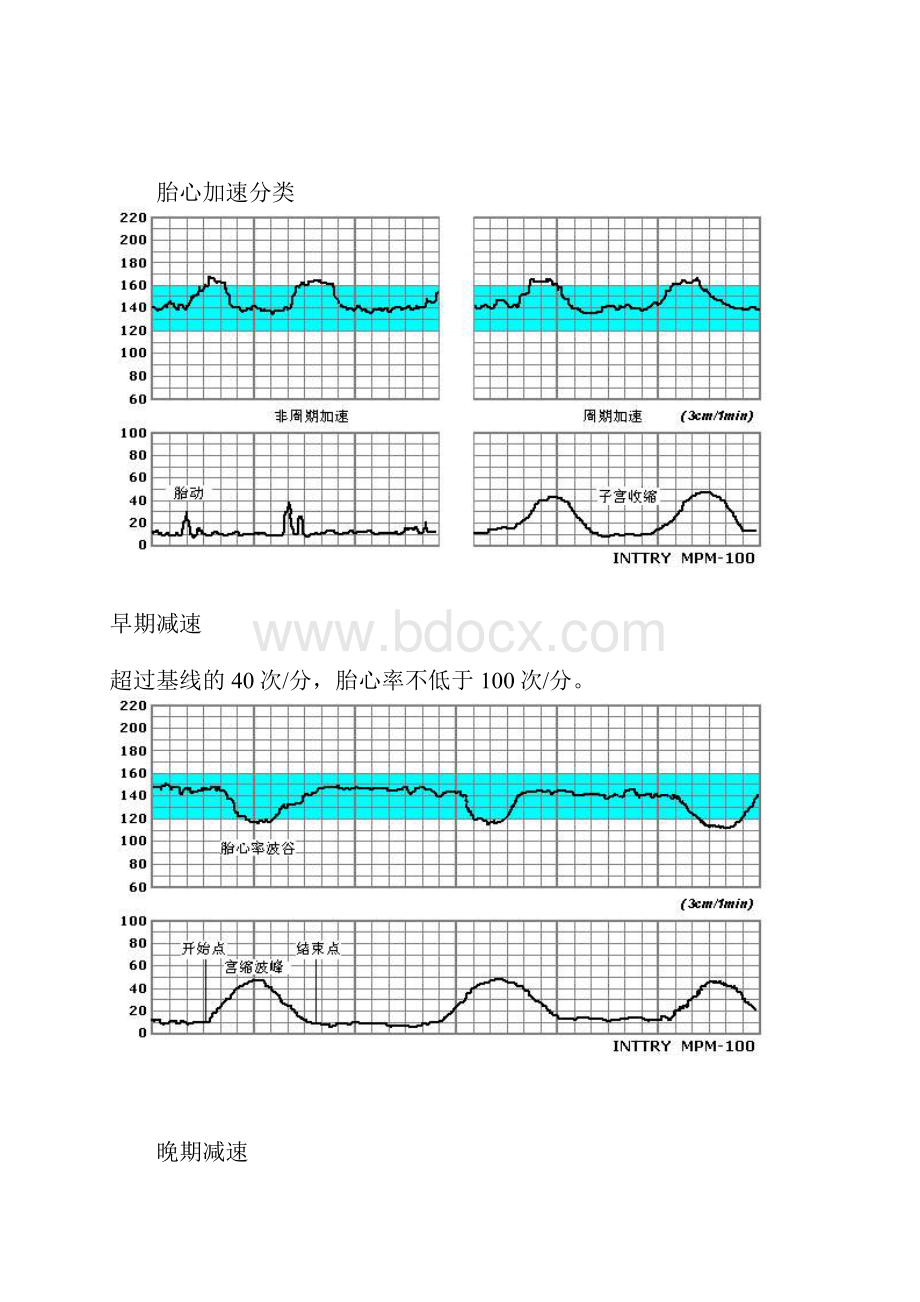 胎心监护图谱精品文档.docx_第2页