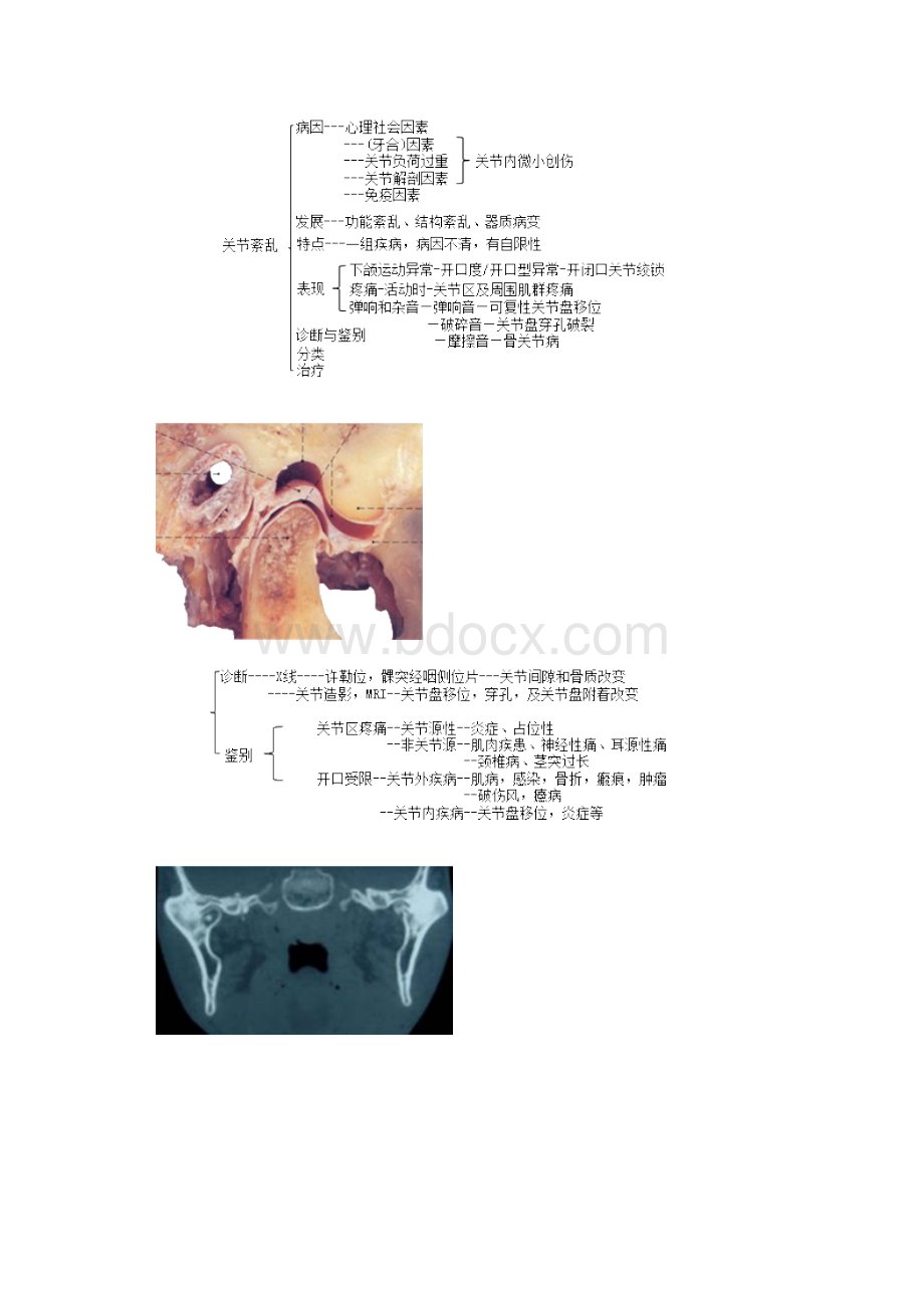 口腔外科学三叉神经痛.docx_第2页