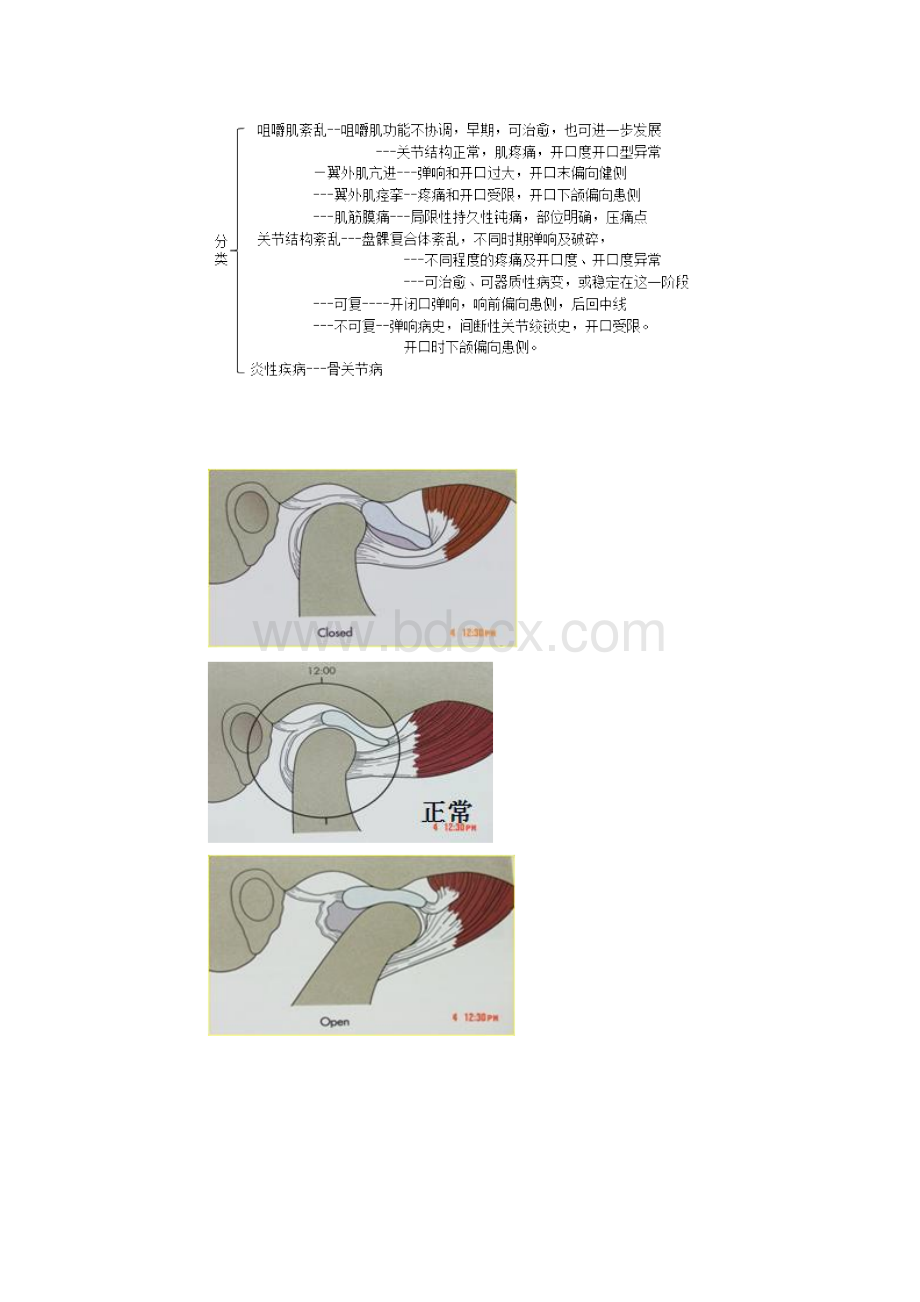 口腔外科学三叉神经痛.docx_第3页