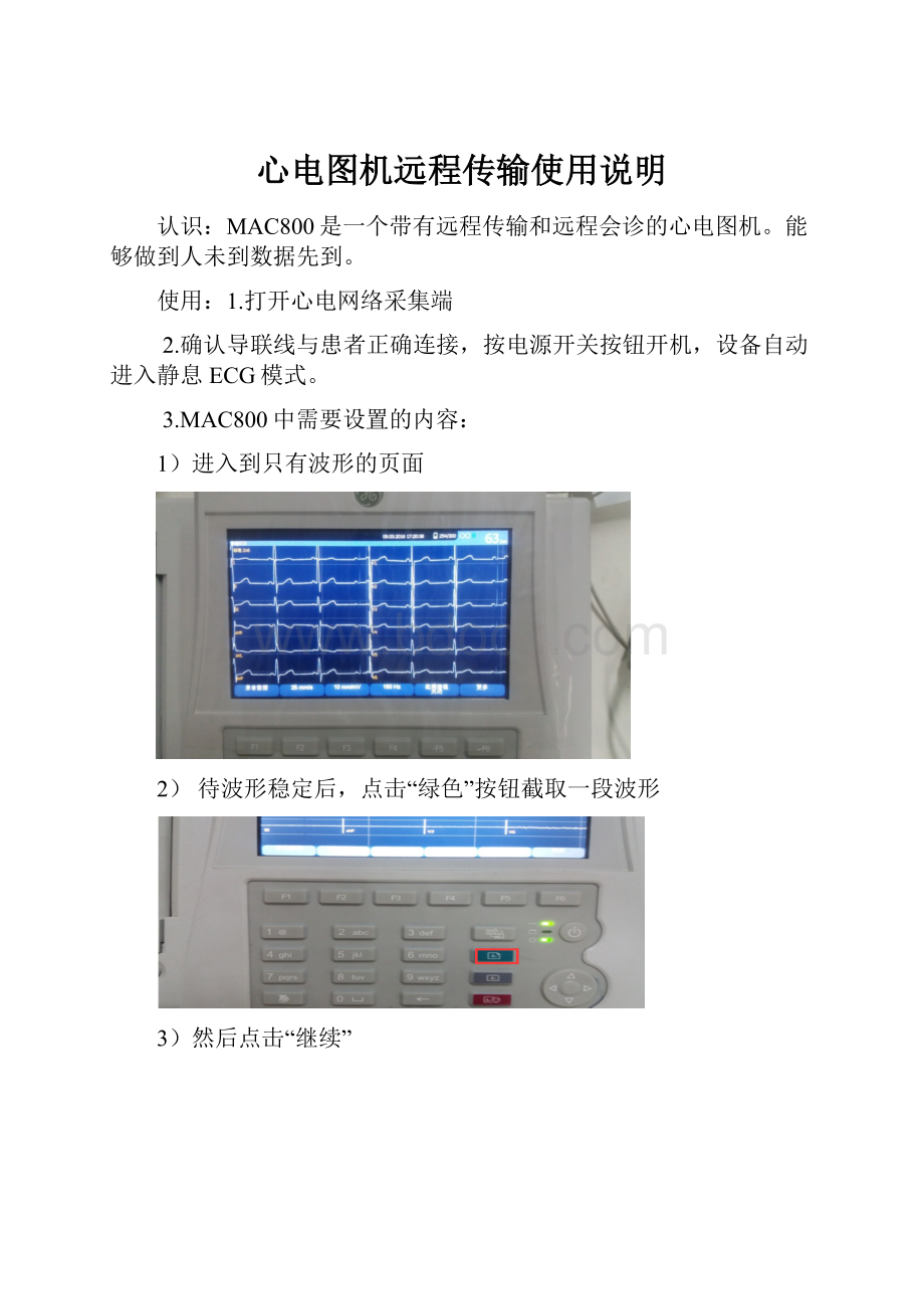 心电图机远程传输使用说明.docx_第1页