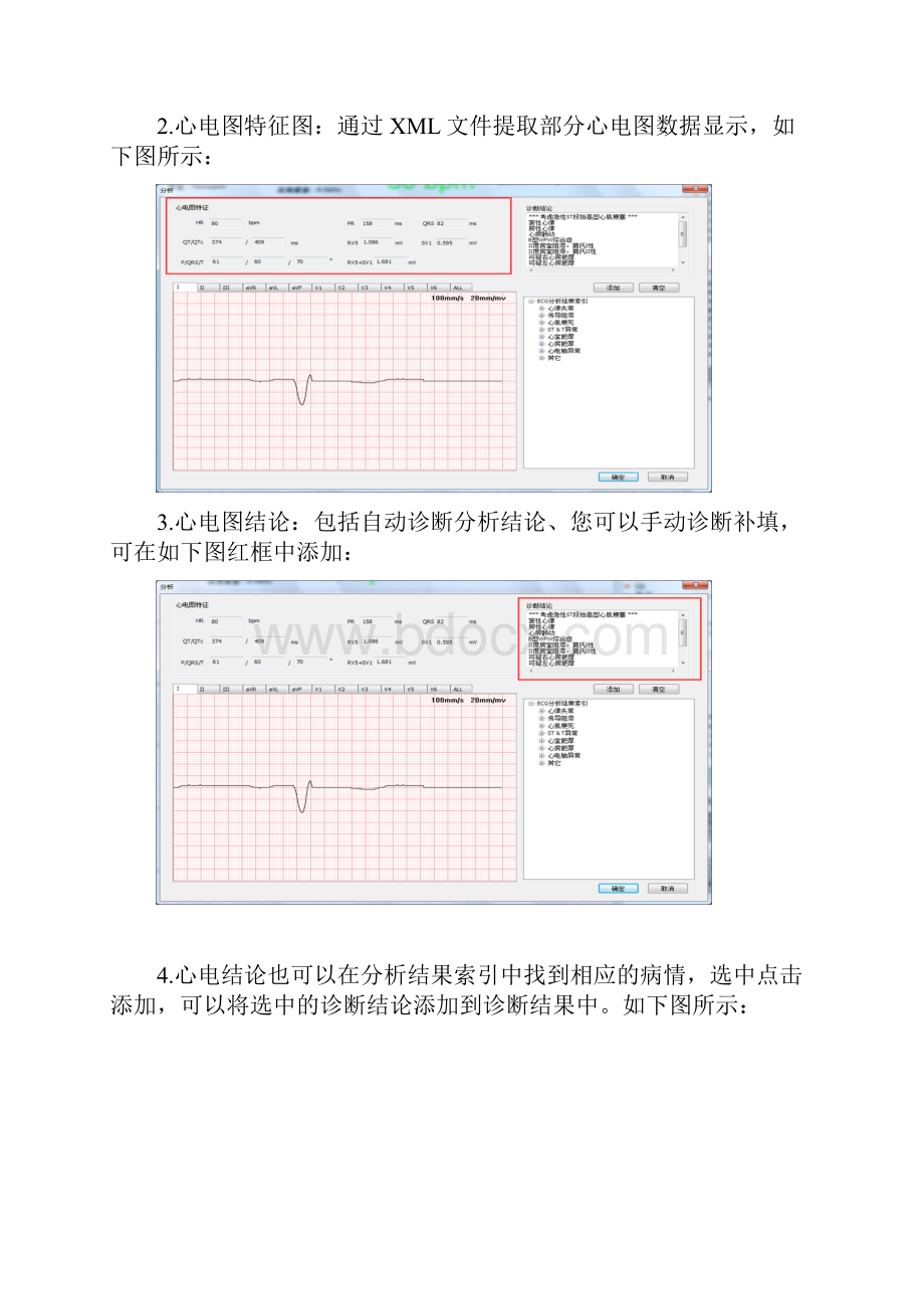 心电图机远程传输使用说明.docx_第3页