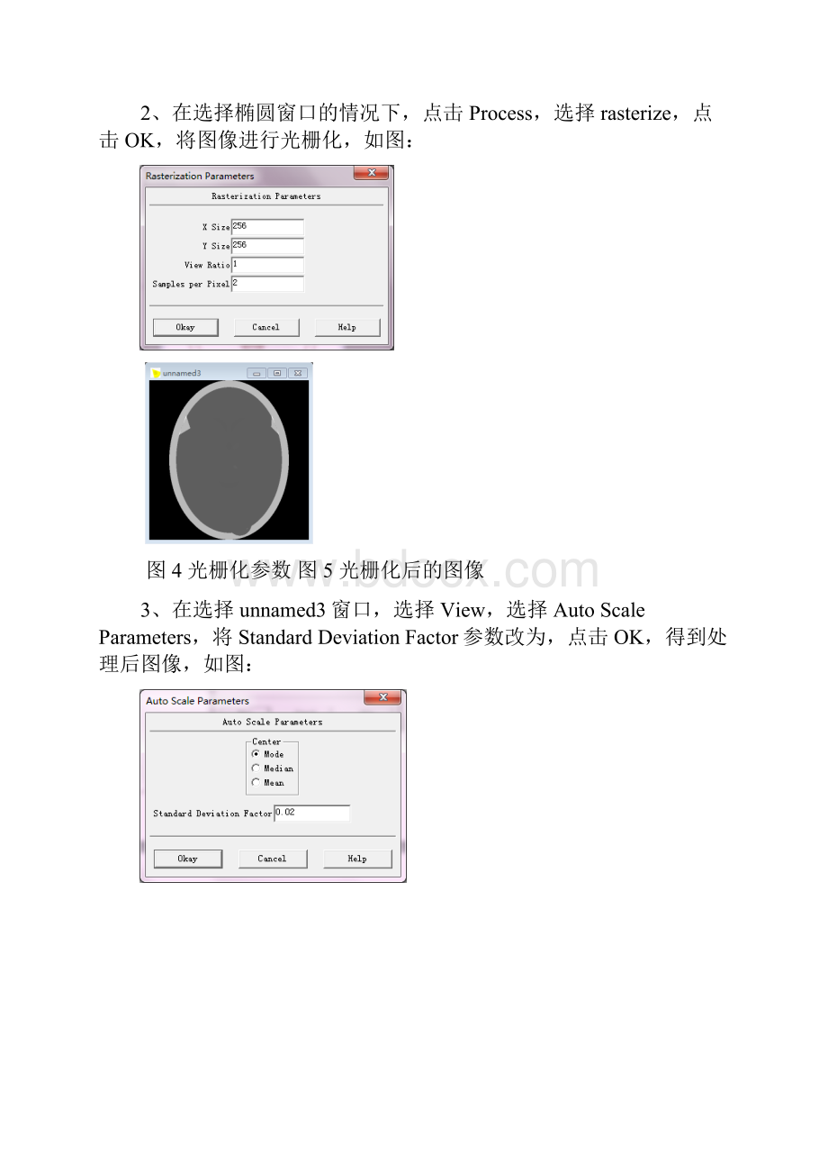 CT仿真实验报告.docx_第3页