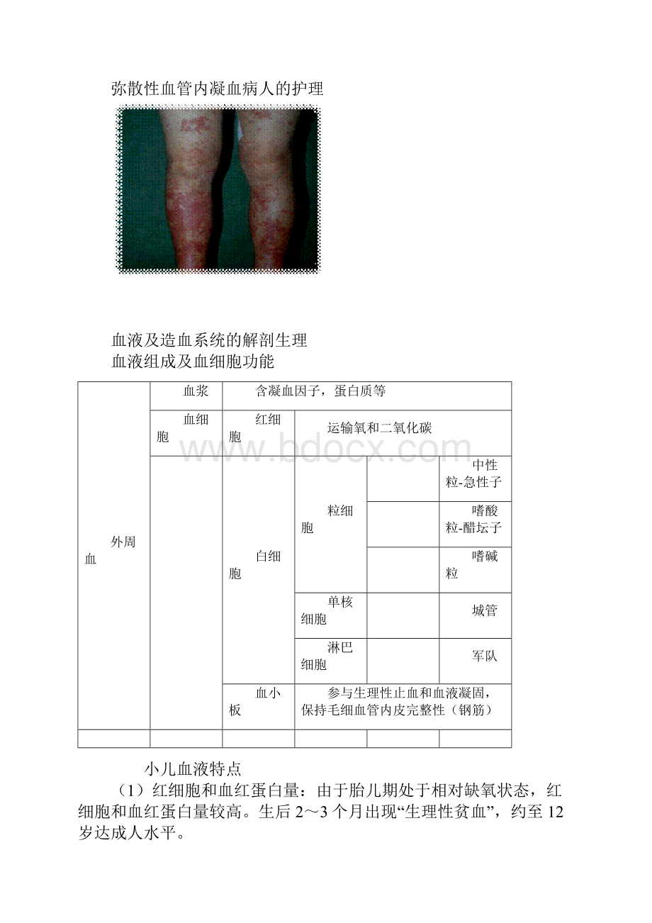 护士资格考试自学张老师精讲第十四章血液造血器官及免疫疾病病人的护理.docx_第2页