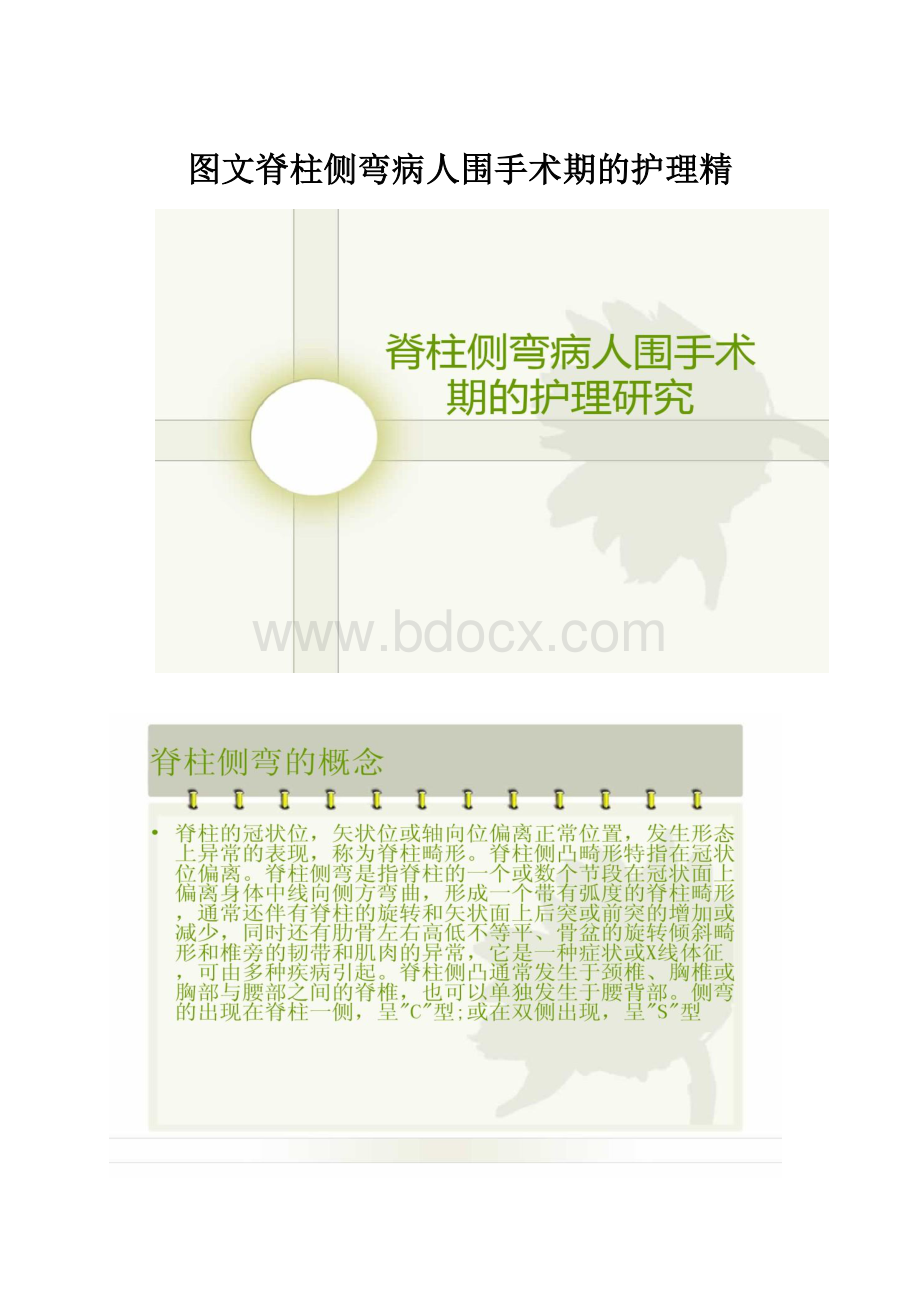 图文脊柱侧弯病人围手术期的护理精.docx_第1页