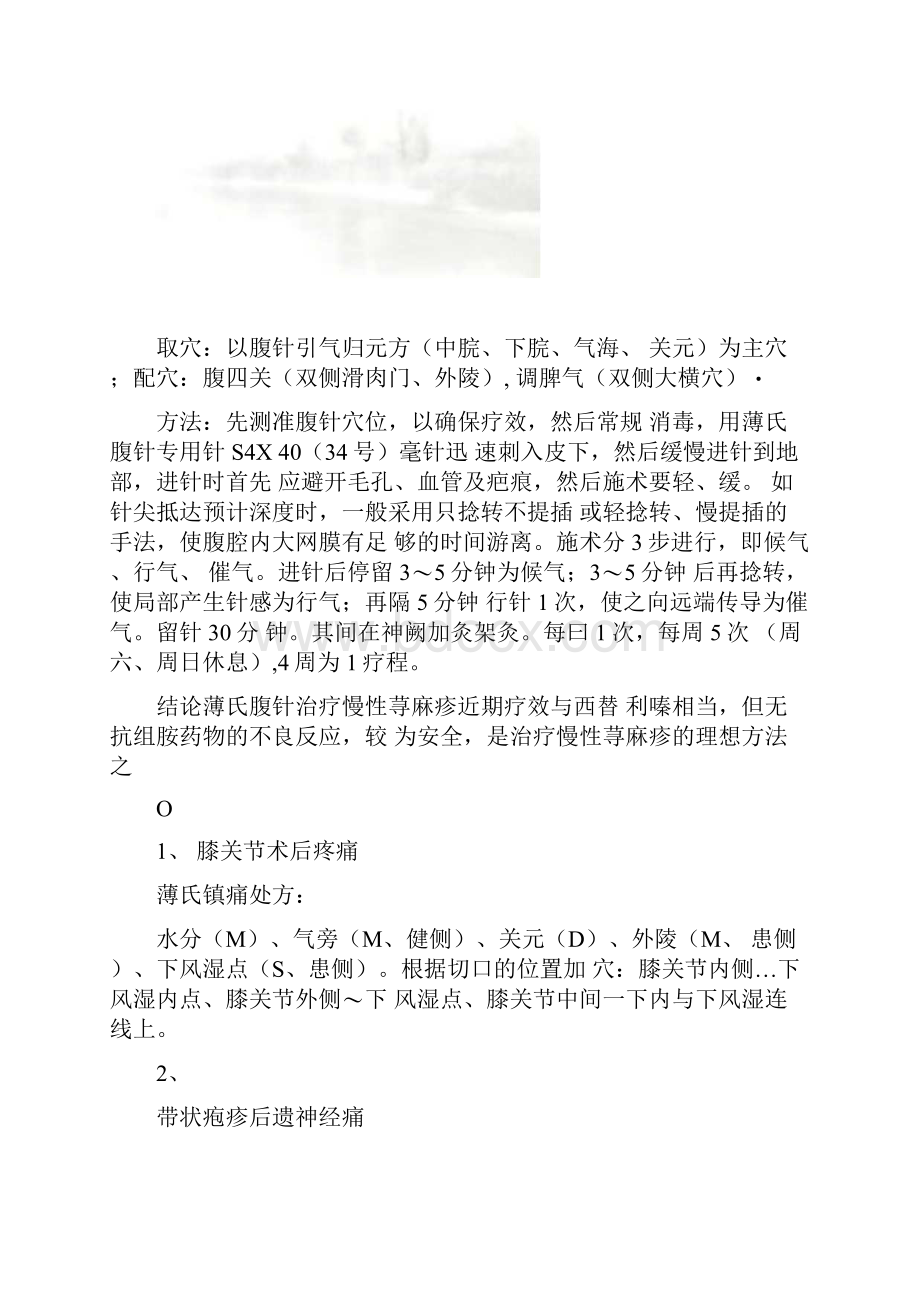 腹针常用穴位及取穴方法.docx_第2页