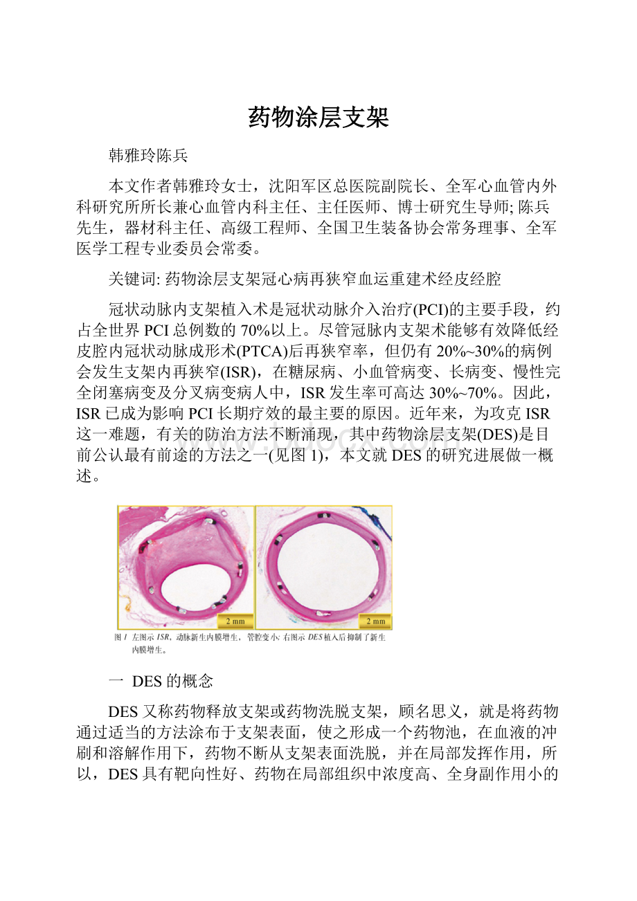 药物涂层支架.docx