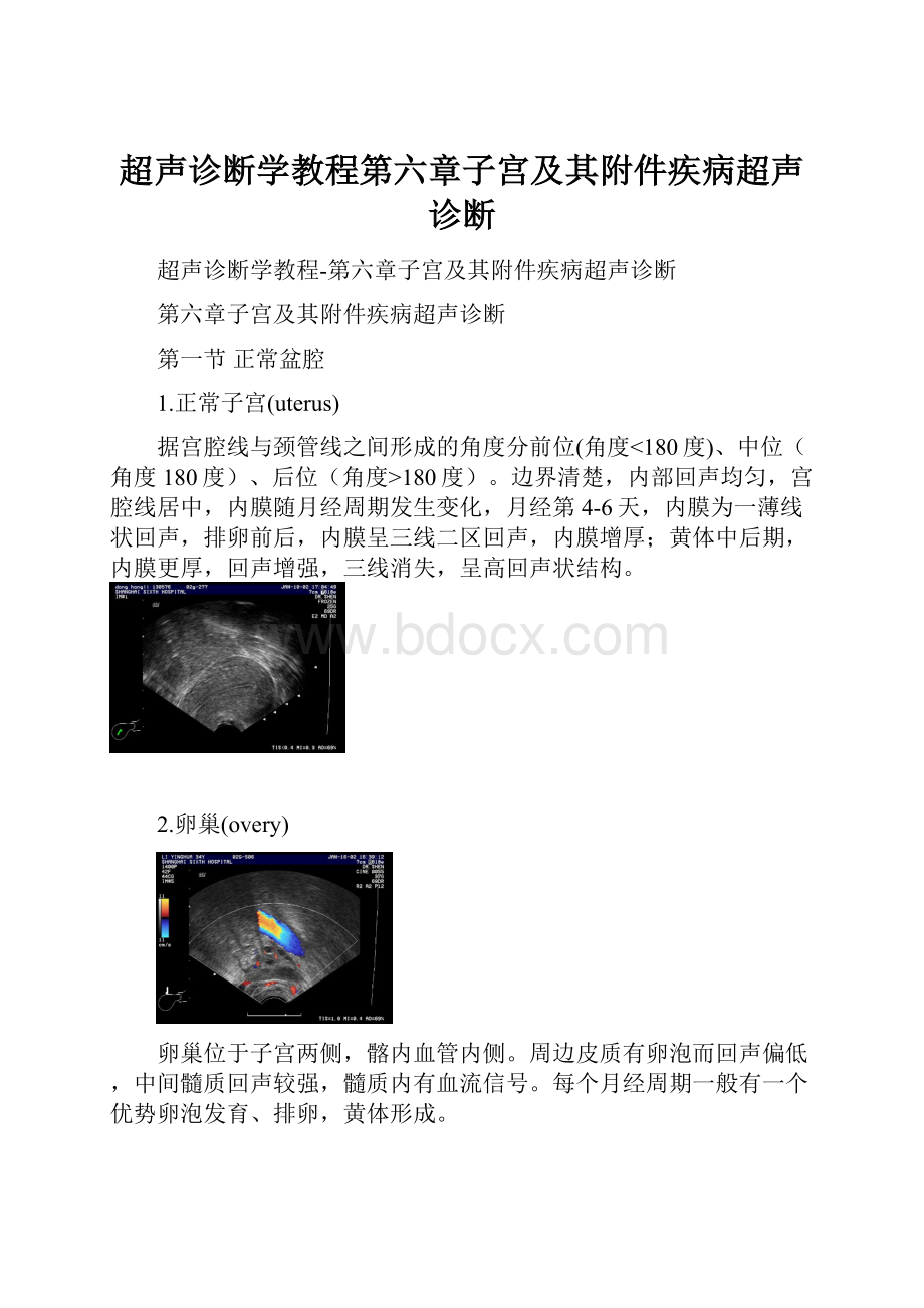 超声诊断学教程第六章子宫及其附件疾病超声诊断.docx_第1页