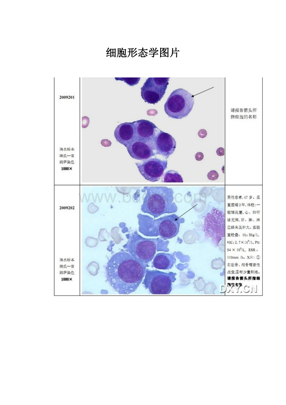 细胞形态学图片.docx_第1页