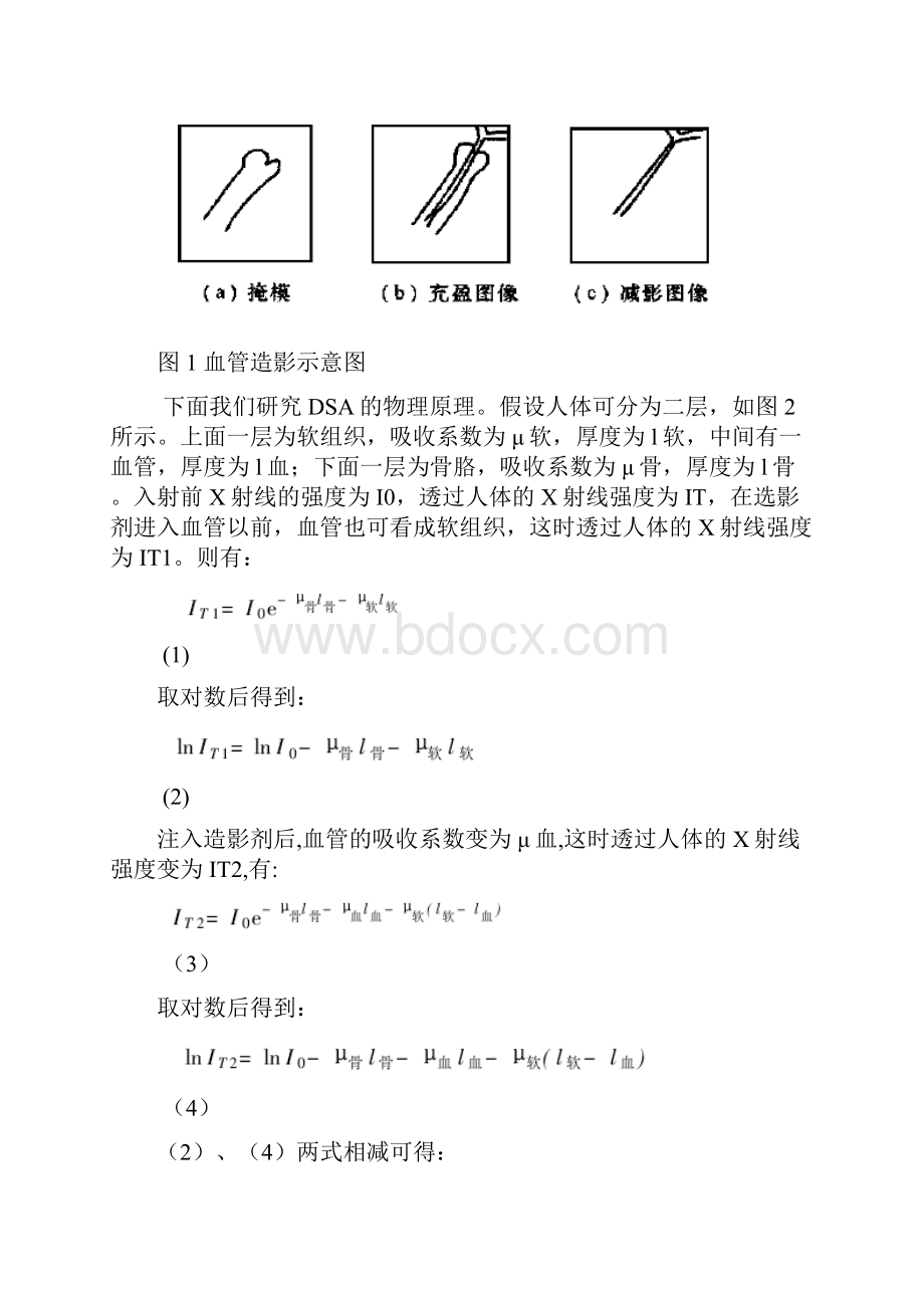 心血管减影技术DSA.docx_第3页