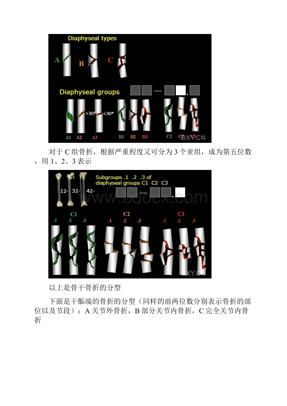 AO分型详细图文解说.docx_第3页