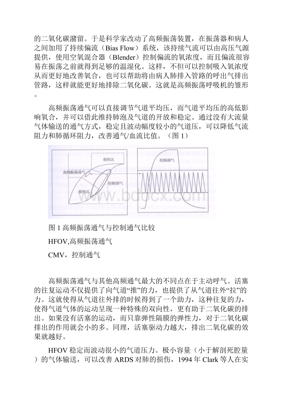 高频振荡通气.docx_第2页