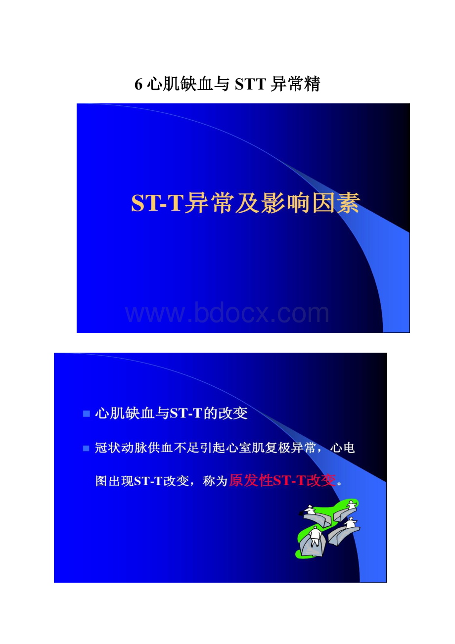 6心肌缺血与STT异常精.docx