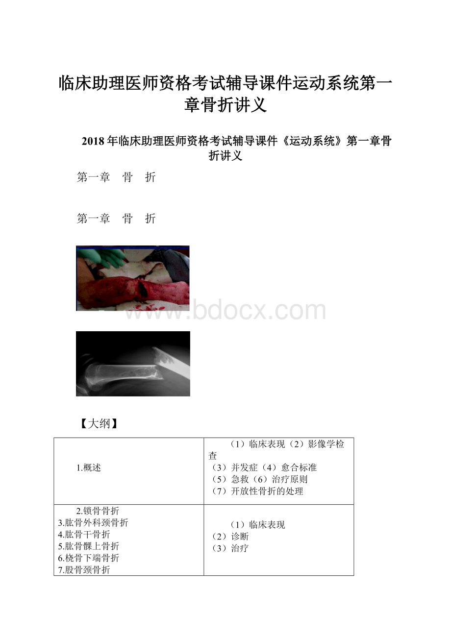 临床助理医师资格考试辅导课件运动系统第一章骨折讲义.docx