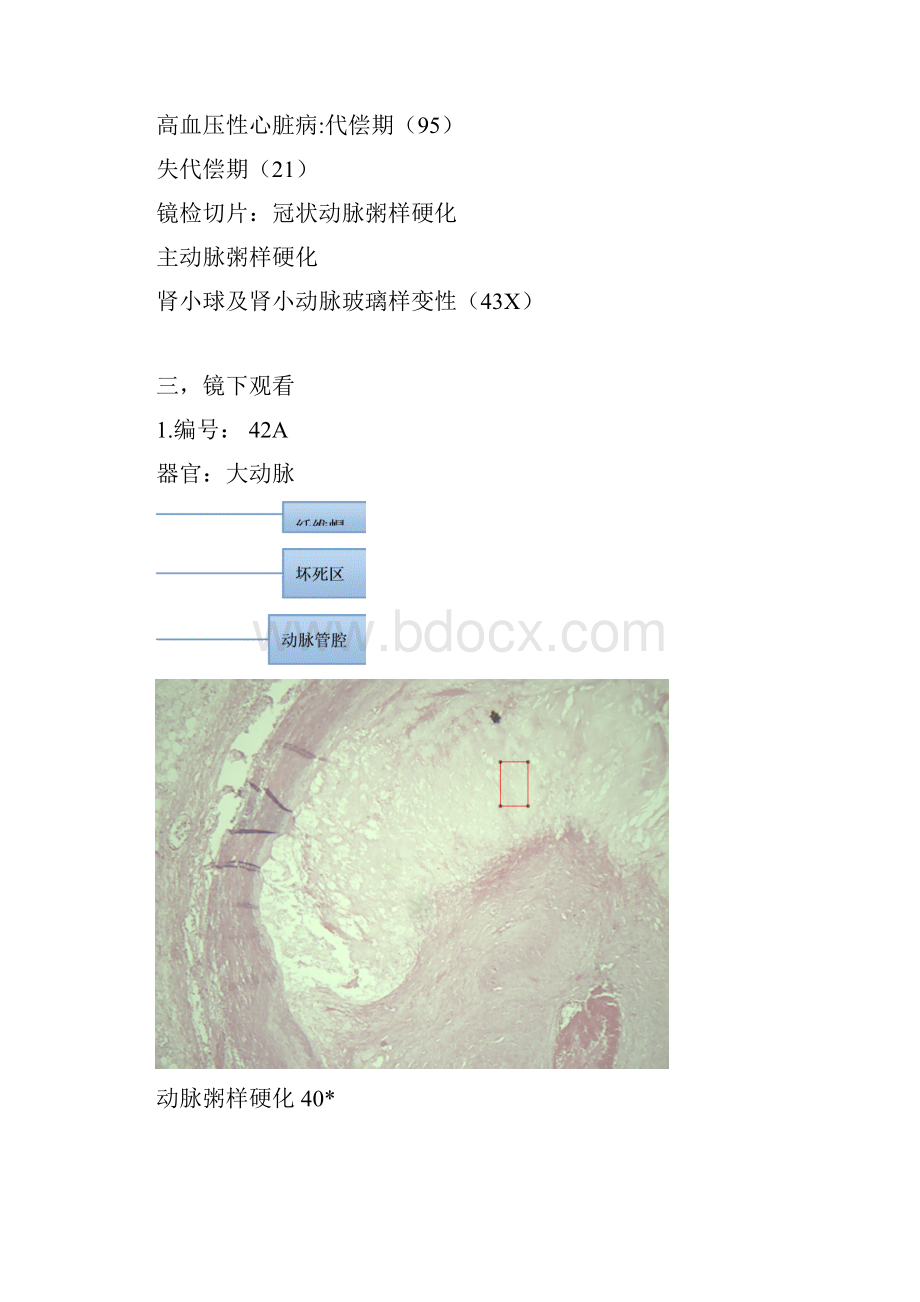 心血管疾病切片与大体观看.docx_第2页