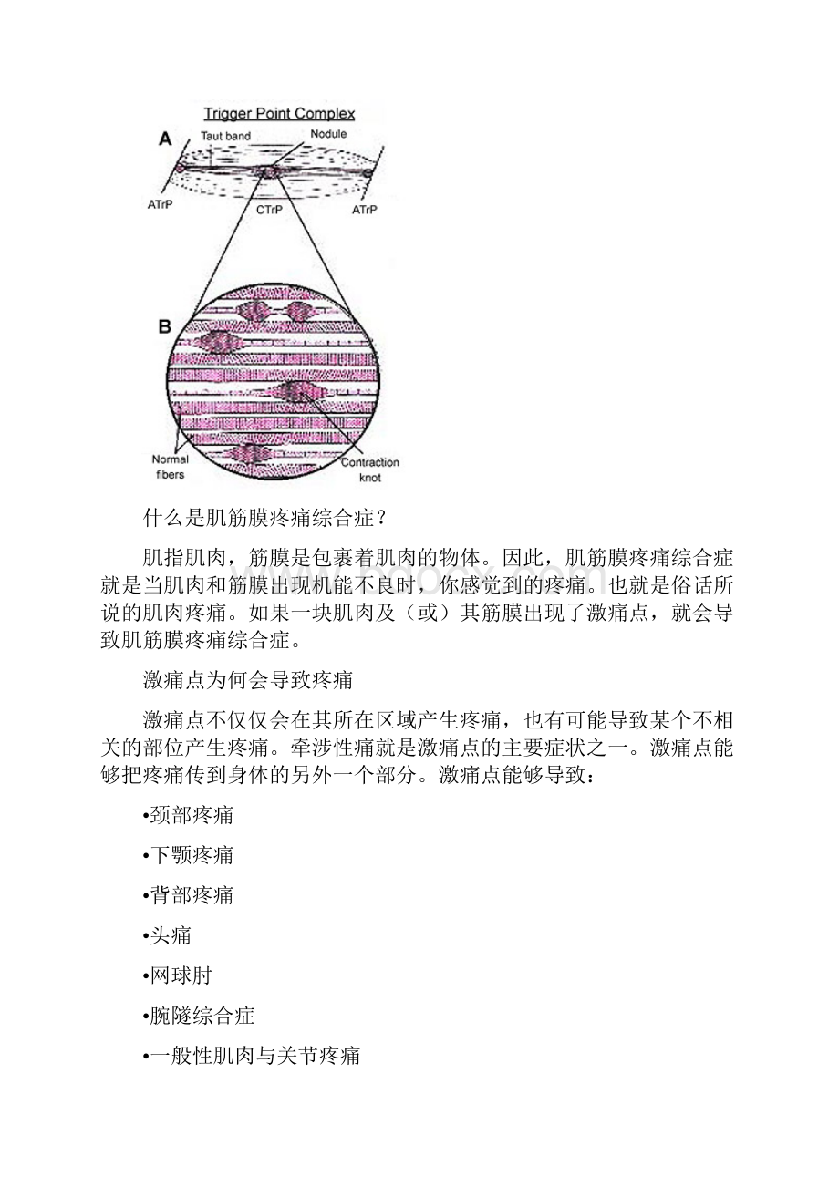 肌筋膜激痛点与还原.docx_第2页