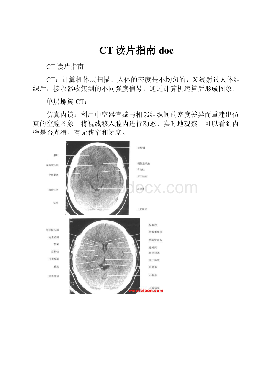 CT读片指南doc.docx