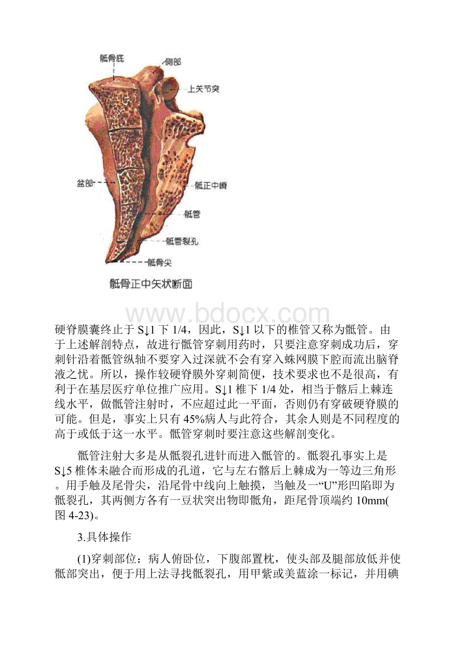 骶管解剖及注射疗法.docx_第2页