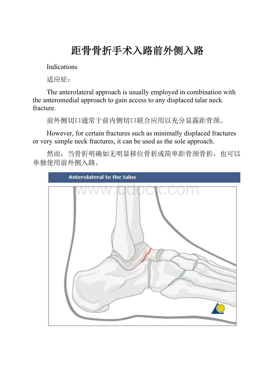 距骨骨折手术入路前外侧入路.docx_第1页