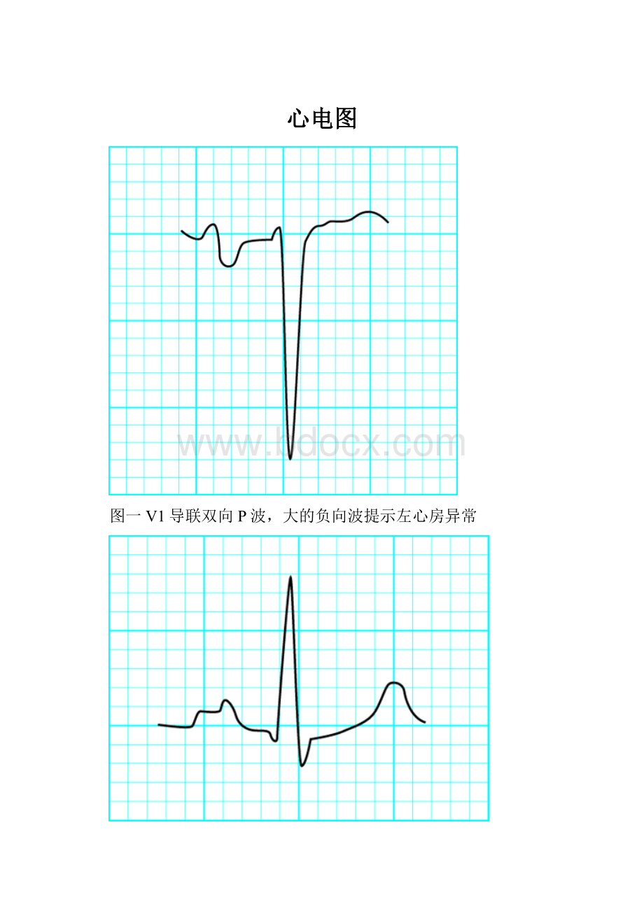 心电图.docx